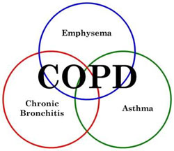Afbeeldingsresultaat voor ziekteproces copd